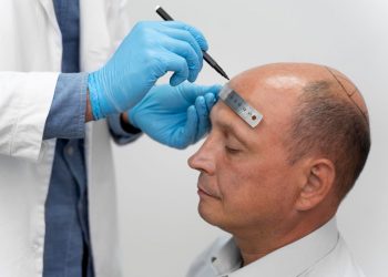 Medart Hair Transplant: A Comprehensive Guide to Restoring Confidence